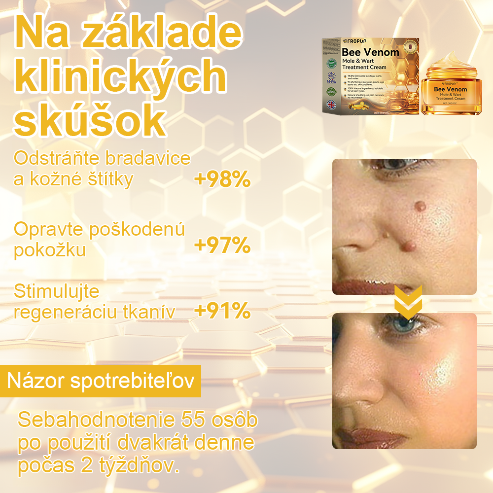 ✨🎁FROPUN krém na odstránenie znamienok a materských znamienok (posledný deň akcie 85% zľava)