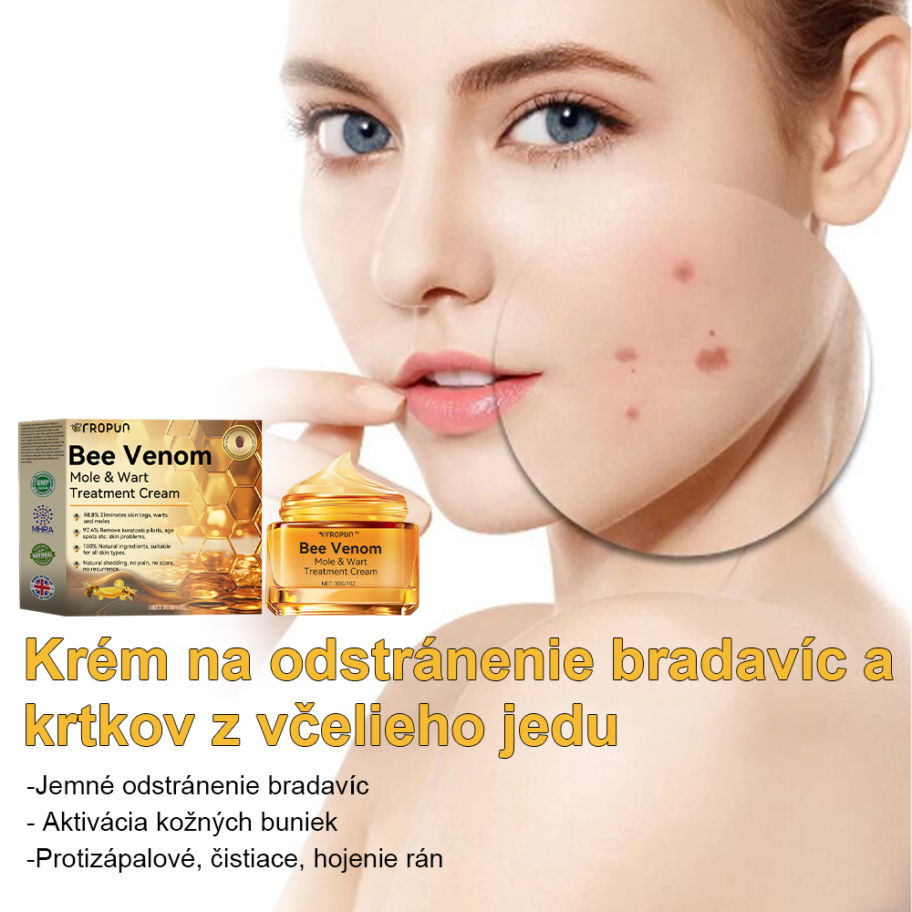 ✨🎁FROPUN krém na odstránenie znamienok a materských znamienok (posledný deň akcie 85% zľava)