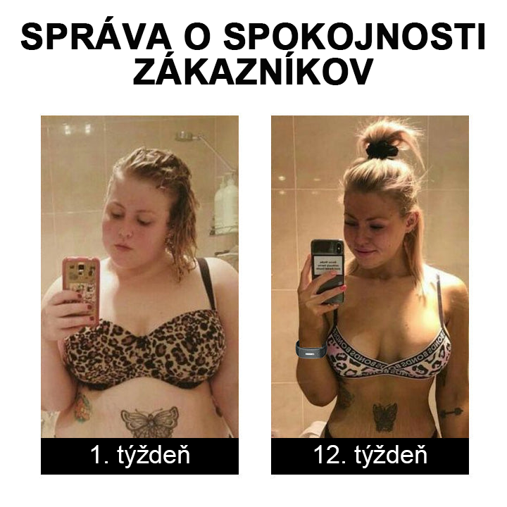 🥑 𝐉𝐎𝐒𝐅𝑰𝐓™ ultrazvukové pásy na odstránenie tuku a detoxikáciu